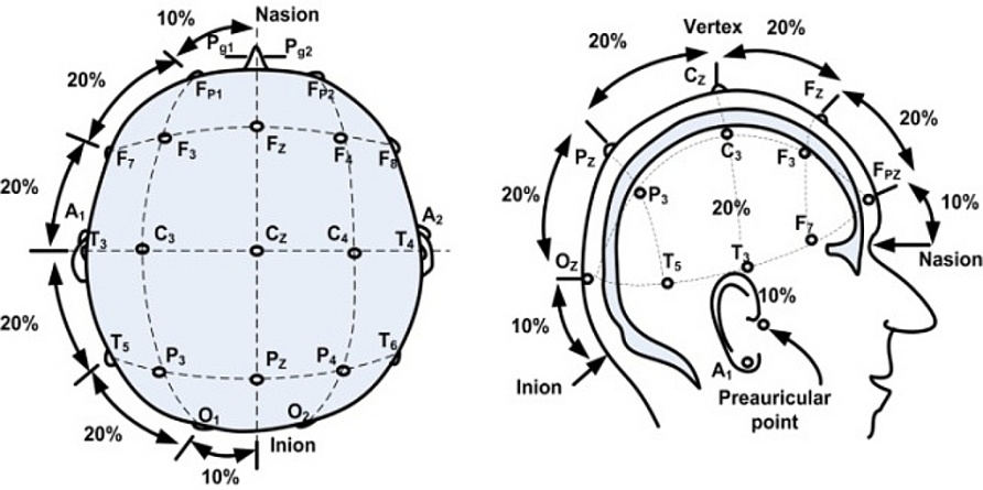 Схема наложения электродов ээг