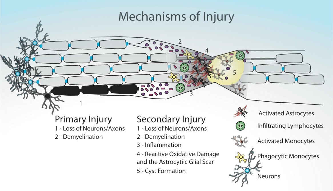 Mechanisms of Injury in SCI. 
